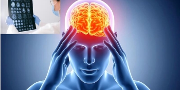 Beyin Tümörü Ameliyatı: Baş Ağrısından Erken Tanıya Giden Yol